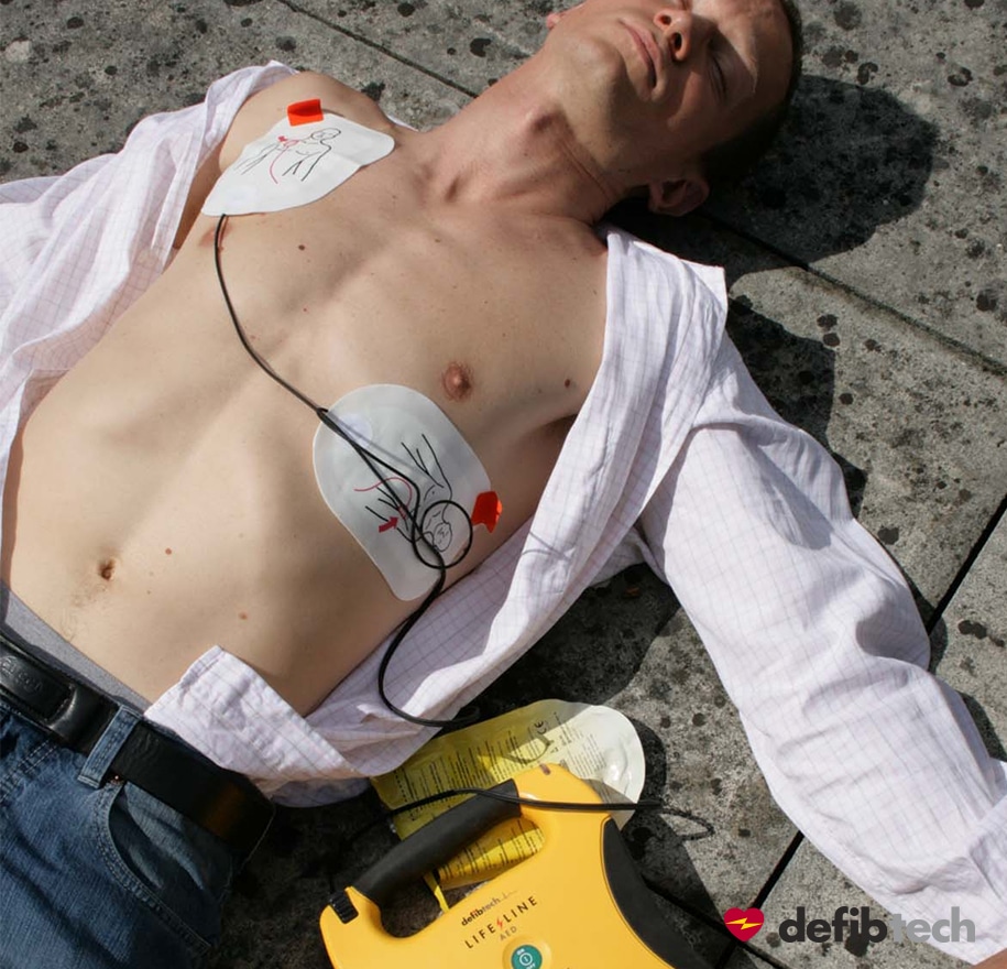 Electrodes adulte Lifeline